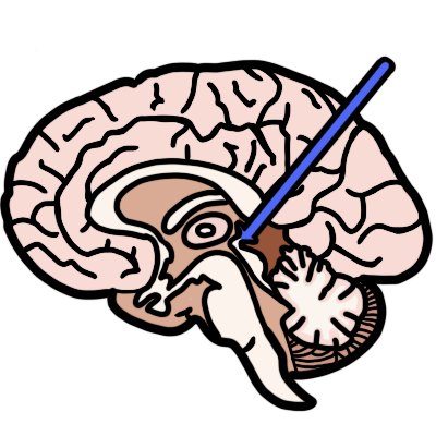A side-view cross-section of a human brain. The pineal gland is highlighted in blue, with a blue line pointing to it.